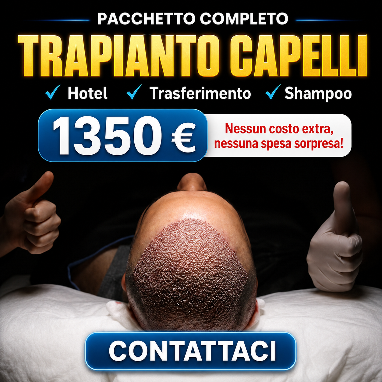 Hair transplant in Tirana
